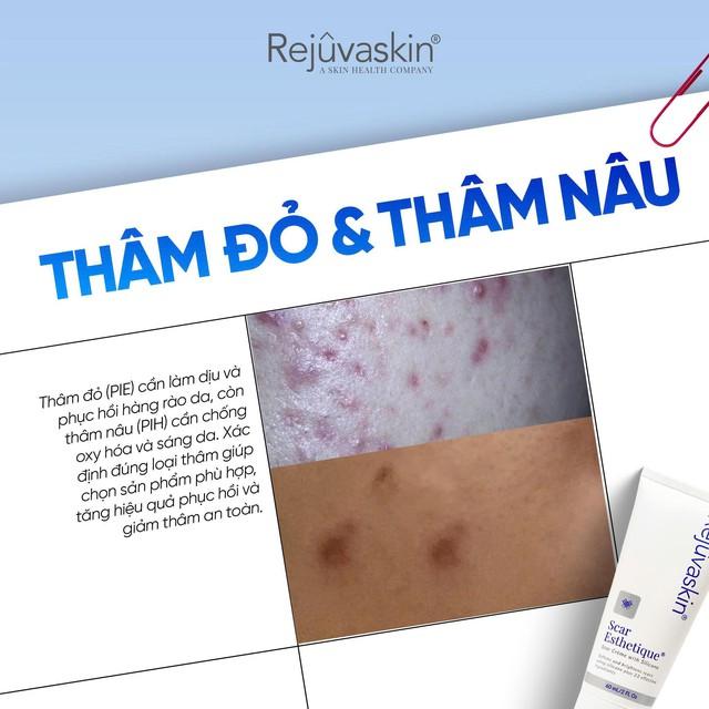 Skincare phục hồi da sau mụn tốt ngừa sẹo rỗ thâm đỏ sau 8 tuần- Ảnh 2.