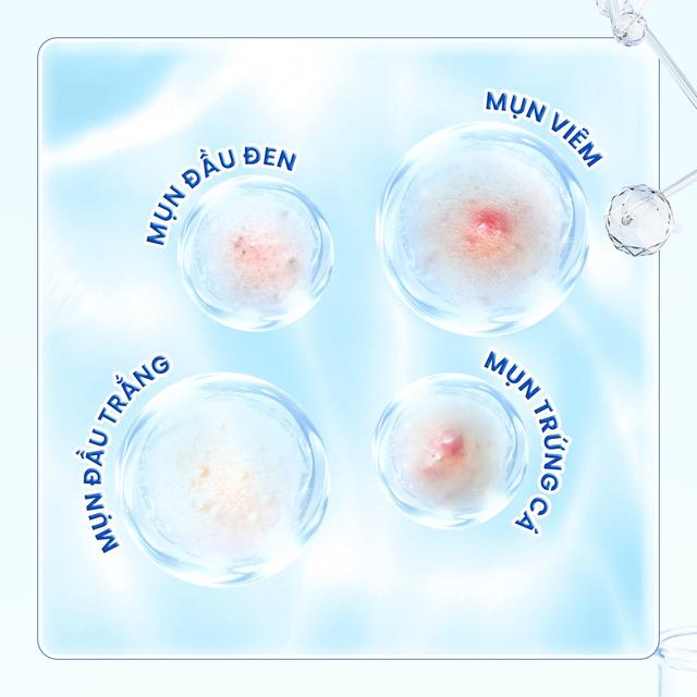 Trioderma - Hành trình thấu hiểu và chăm sóc làn da dầu mụn người Việt- Ảnh 3.