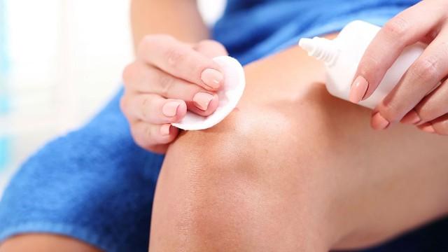 Khi nào nên chọn Hema để chăm sóc vết thương?- Ảnh 4.