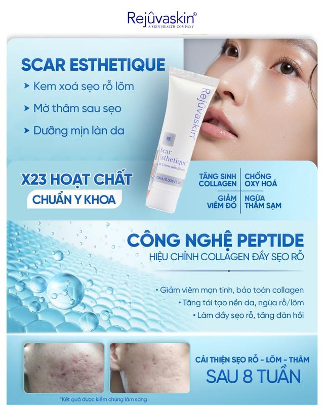 Cải thiện thâm mụn trong 4 tuần với một bước chăm da cuối cùng - Ảnh 4.