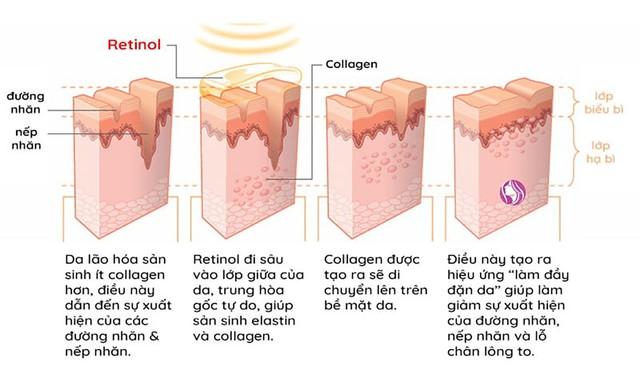 Retinol là gì mà khiến da lão hóa 'chậm lại' sau vài tuần dùng?- Ảnh 4.
