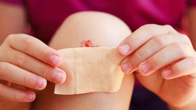 Phòng ngừa nhiễm trùng từ vết thương hở: Bật mí từ chuyên gia da liễu- Ảnh 5.