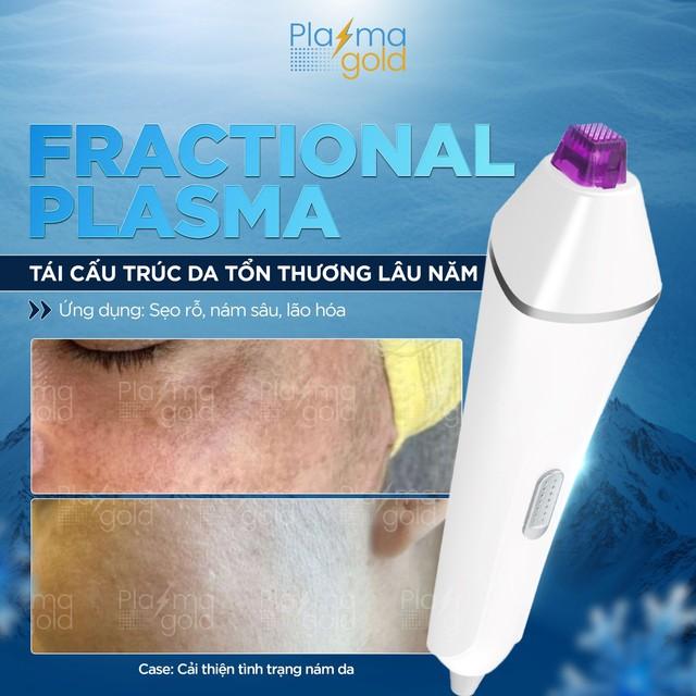 Plasma Lạnh trị sẹo rỗ và se khít lỗ chân lông như thế nào?- Ảnh 9.