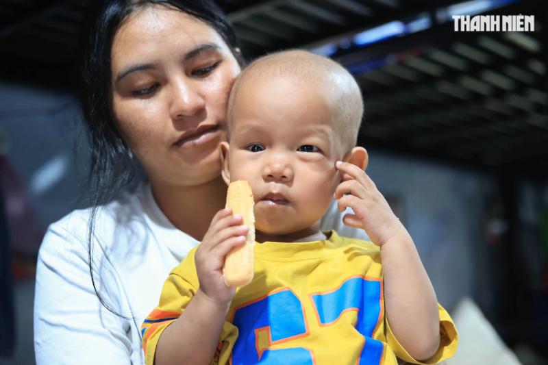 Bé trai nguy cơ mất ánh sáng vì ung thư mắt, gia đình kiệt quệ cầu cứu- Ảnh 4.