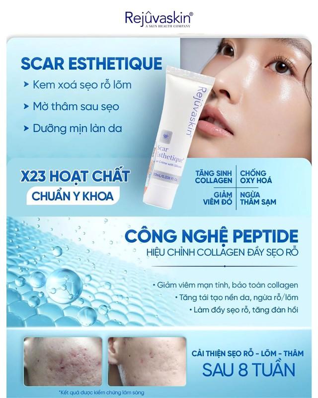 Sẹo mụn hình thành như thế nào? Hiểu nguyên nhân nắm rõ cách xóa sẹo hiệu quả- Ảnh 3.