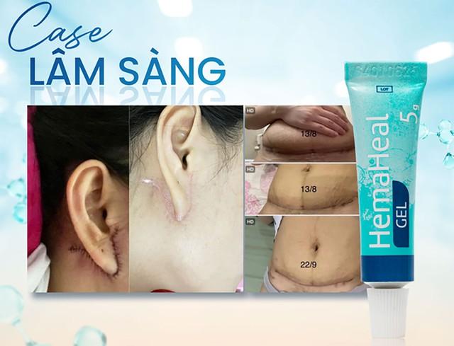 Review gel lành thương HemaHeal có tốt không mà được chuyên gia, phòng khám tin dùng?- Ảnh 5.