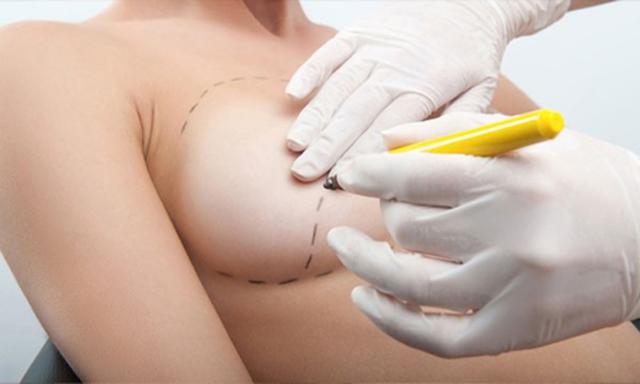 Lành đẹp và an toàn cho vết thương hậu tạo hình ngực với HemaHeal - Ảnh 2.