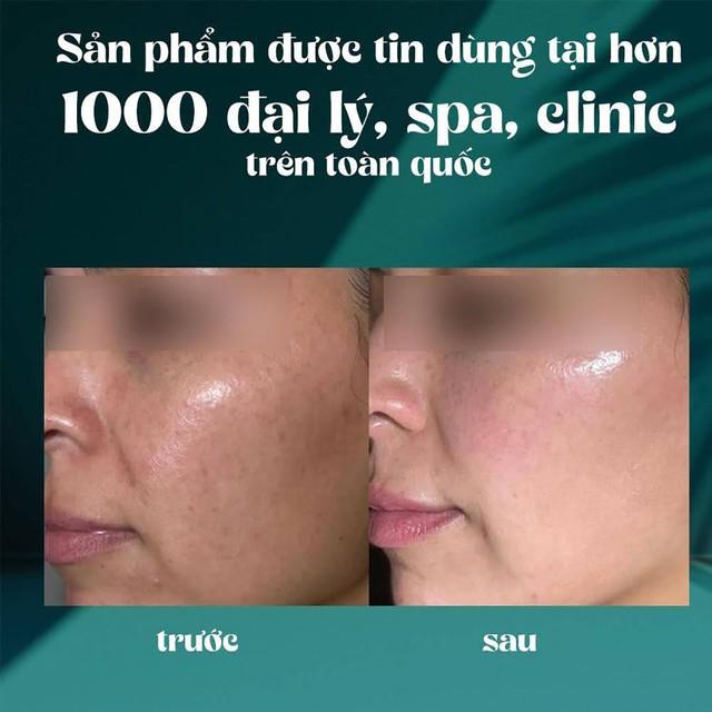  - Ảnh 3.