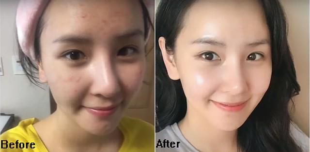 Top 10 kem chống nắng cho da mụn: Ai dùng rồi cũng nguyện chung thủy tới già - Ảnh 1.