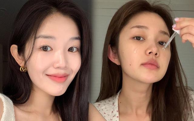 Da xám xỉn, thâm mụn lâu năm cỡ nào cũng thua top 3 serum vitamin C này - Ảnh 1.
