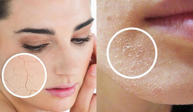 Tuyệt chiêu mới giúp da ẩm mịn, căng bóng ngay trong mùa lạnh hanh khô- Ảnh 2.