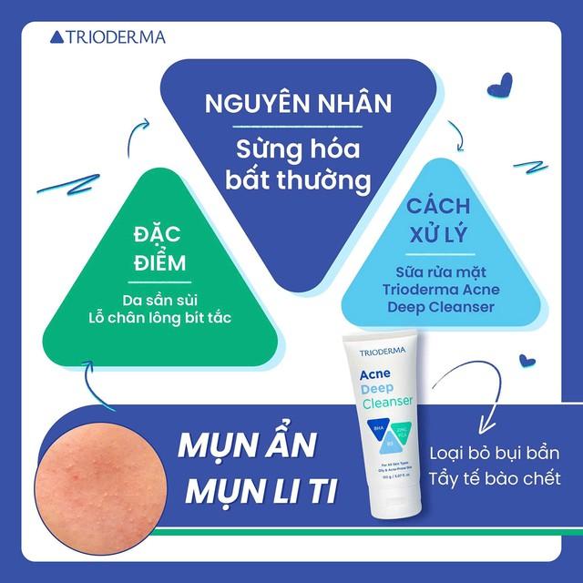 Bất ngờ chưa: Trioderma ngừa mụn ẩn hiệu quả đến mức chuyên gia cũng phải công nhận!- Ảnh 3.