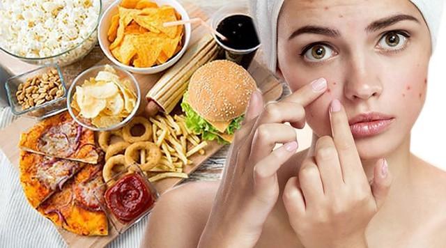 Ghim ngay cách cải thiện mụn tại nhà đơn giản mà hiệu quả, ngừa tái phát- Ảnh 4.