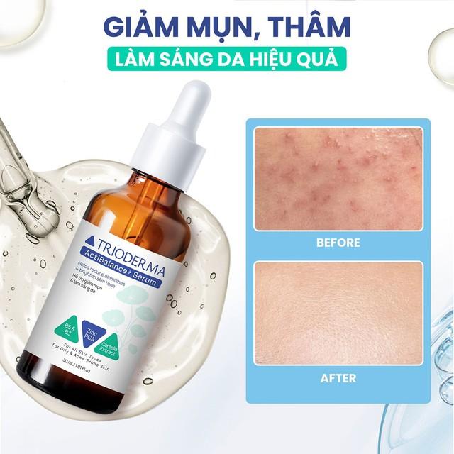 Serum phản chủ! Da liễu tiết lộ lỗi sai tối kỵ khiến da xấu đi- Ảnh 5.