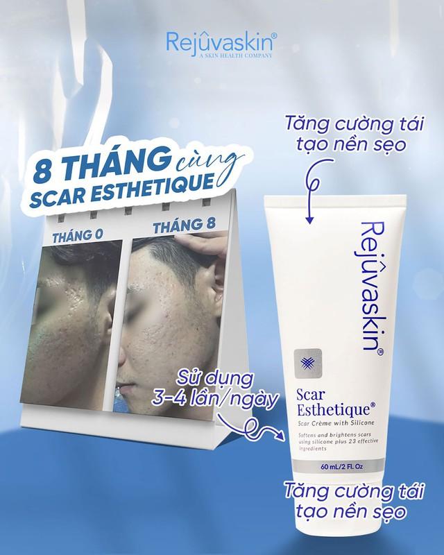 Mụn thâm đen cứng đầu, lâu năm cải thiện bật sáng đều màu sau 7 ngày- Ảnh 7.