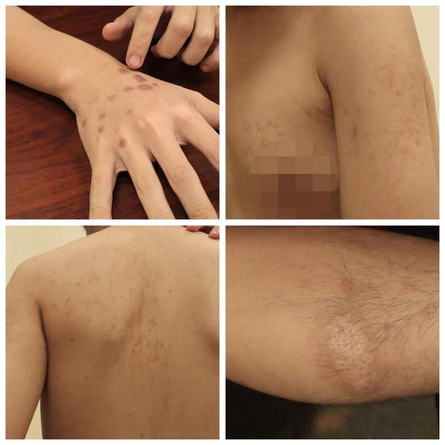 Bẫy lừa đảo xuyên biên giới: Tra tấn bằng nhựa nóng, chích điện- Ảnh 2. Bẫy lừa đảo xuyên biên giới: Tra tấn bằng nhựa nóng, chích điện- Ảnh 2.
