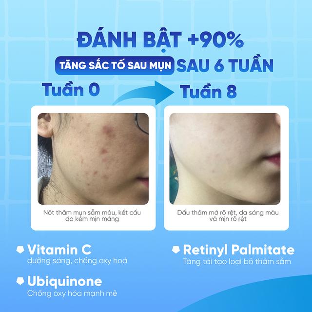  - Ảnh 3.