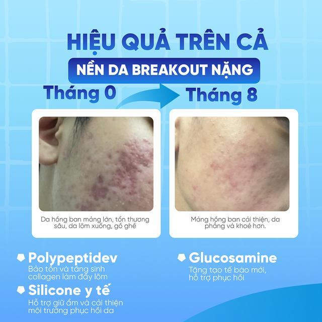  - Ảnh 4.