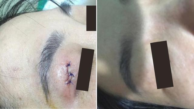 Hema và kỷ nguyên phục hồi từ giai đoạn 0 trong thẩm mỹ hiện đại- Ảnh 3.