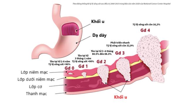 Chỉ chậm 2 tháng, ung thư đã hình thành: Tầm soát sớm và định kỳ thế nào?- Ảnh 1.