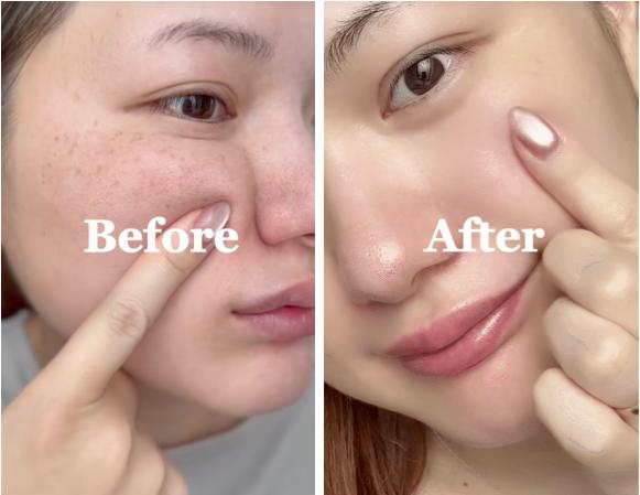 Top 7 serum làm mờ nám đậm, nám sâu tới đâu cũng hiệu quả- Ảnh 1.
