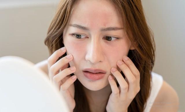 Cách dùng mặt nạ dưỡng da tưởng càng đắp càng đẹp, ai ngờ ngược lại- Ảnh 2.