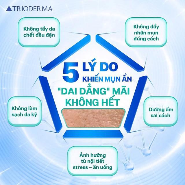 Mụn sâu tới đâu cũng đánh bật, không sẹo nhờ cách ngừa mụn ẩn chuẩn chuyên gia- Ảnh 3.