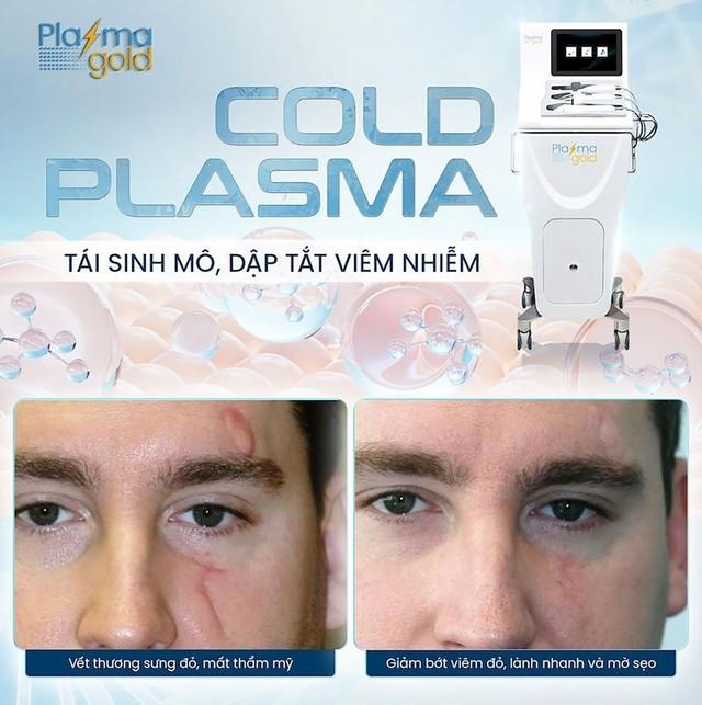 Plasma Gold khẳng định vai trò tiên phong trong công nghệ Plasma làm đẹp và lành thương- Ảnh 3.