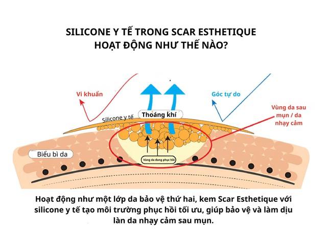 Da sau mụn: Giải mã tiến trình phục hồi sinh học dưới góc độ chuyên gia- Ảnh 3.
