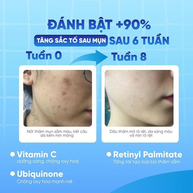 Hiệu quả lâm sàng cho thấy công dụng cải thiện nền da sau breakout của Scar Esthetique - Ảnh 3.