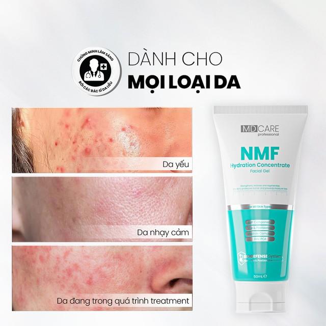 Hậu party da ‘ngộp thở’: Tối giản 5 bước skincare chuẩn da gương- Ảnh 4.
