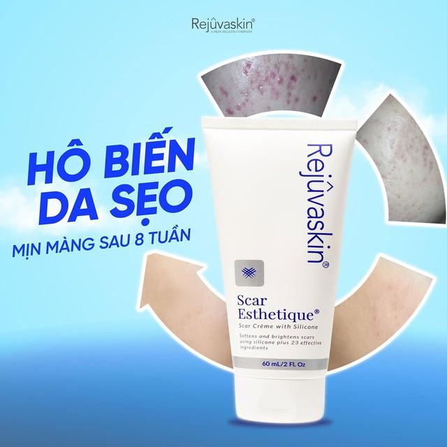 Phục hồi da sau nặn mụn để hạn chế sẹo - Điều nhiều người đang bỏ qua- Ảnh 4.