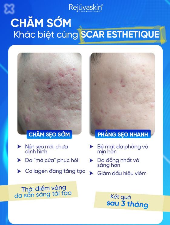 Hướng dẫn sử dụng kem làm mờ sẹo rỗ Rejuvaskin Scar Esthetique đúng chuẩn y khoa - Ảnh 5.