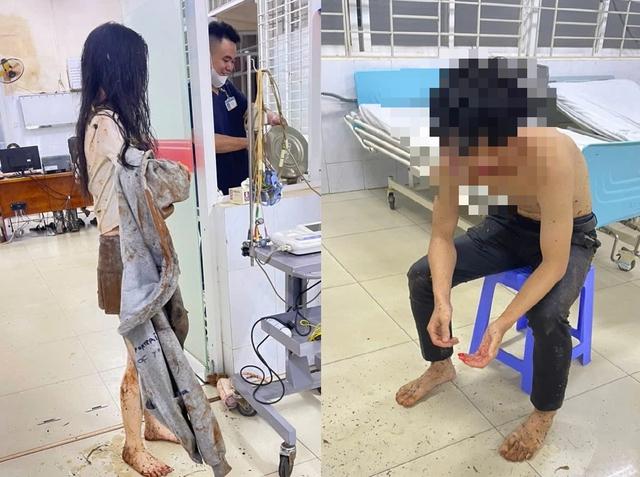 Giải cứu thành công 2 bạn trẻ rơi xuống giếng hoang ở Long Khánh- Ảnh 2.