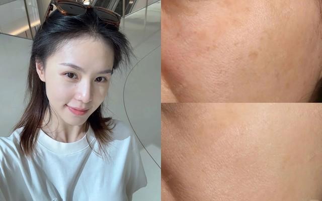 Top 3 serum tranexamic acid giúp mờ nám sạm sau 4 tuần dù námchân sâu, lâu năm - Ảnh 1.
