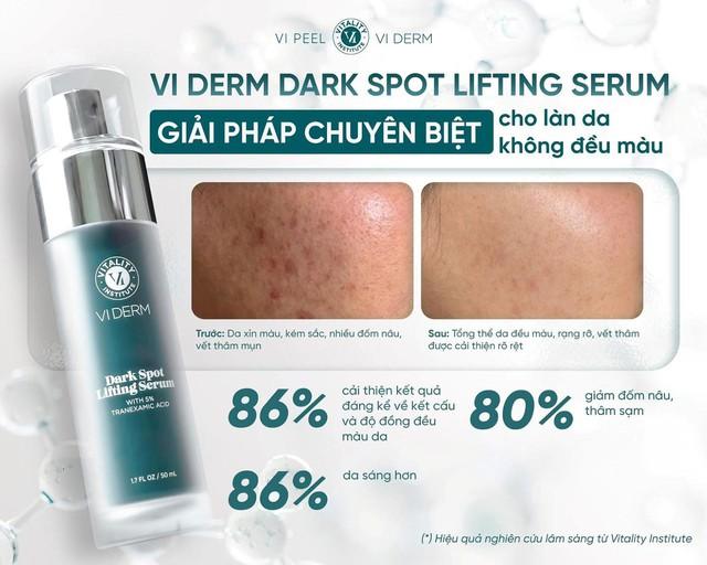 Top 3 serum tranexamic acid giúp mờ nám sạm sau 4 tuần dù námchân sâu, lâu năm - Ảnh 2.