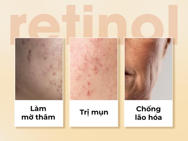 Làm đẹp da láng mịn không thâm mụn Nhờ skincare chuẩn y khoa tại nhà - Ảnh 8.