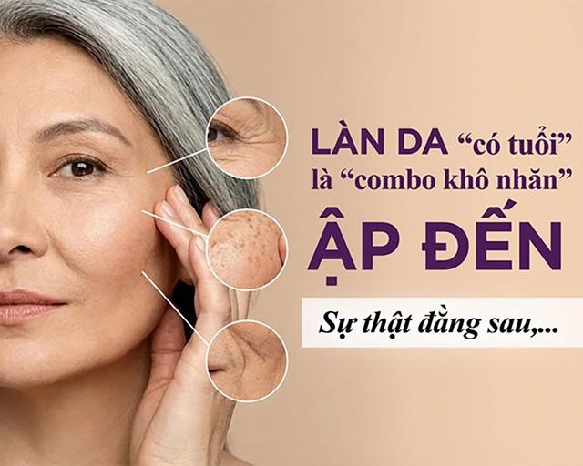 Làn da có tuổi là ‘combo’ khô nhăn ập đến: Sự thật phũ phàng đằng sau! - Ảnh 1.