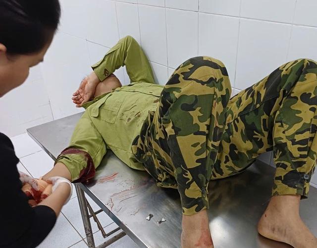 Đi kiểm tra rừng, một bảo vệ bị người đàn ông lạ mặt chém bị thương 
- Ảnh 2.