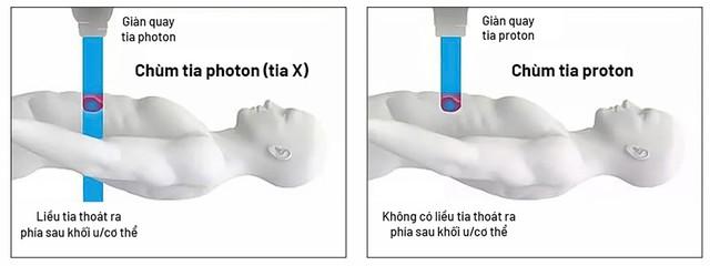 Việt Nam mua ‘siêu máy nghìn tỉ’ điều trị ung thư của Mỹ ngay dịp tết - Ảnh 3.