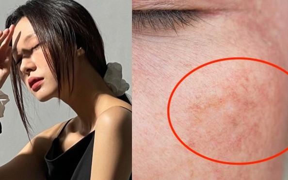 4 serum mờ nám, tàn nhang ai cũng bất ngờ vì hiệu quả với cả chân sâu - Ảnh 1.