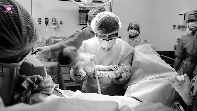 TP.HCM: Một ca mổ, bốn thủ thuật giúp sản phụ nguy cơ cao mẹ tròn con vuông- Ảnh 2.