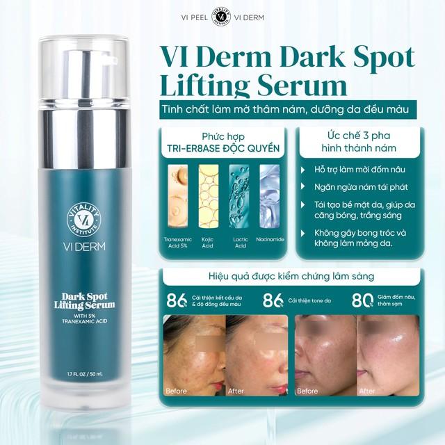 4 serum mờ nám, tàn nhang ai cũng bất ngờ vì hiệu quả với cả chân sâu - Ảnh 2.