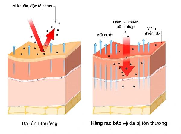 Ảnh hưởng của thời tiết đến hàng rào bảo vệ da- Ảnh 2.