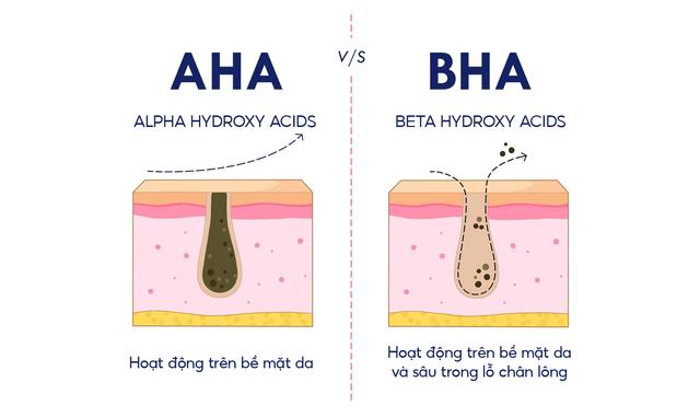 Da mụn nên dùng BHA hay AHA - phương pháp chăm da mụn chuẩn khoa học- Ảnh 3.