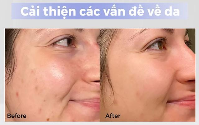 Dùng mãi da vẫn xỉn màu, thử ngay top 7 kem dưỡng trắng da dưới đây- Ảnh 3.