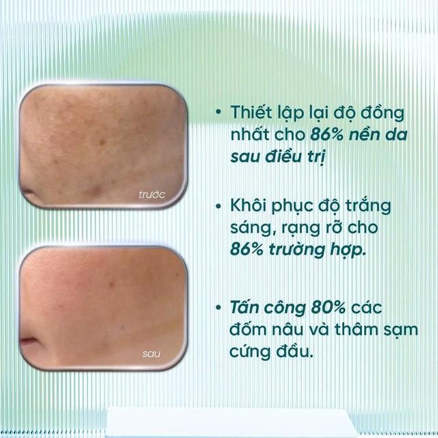 4 serum mờ nám, tàn nhang ai cũng bất ngờ vì hiệu quả với cả chân sâu - Ảnh 3.
