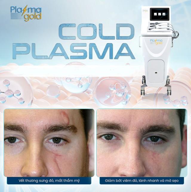 Mua máy Plasma Lạnh ở đâu để spa đầu tư không lo rủi ro?- Ảnh 4.