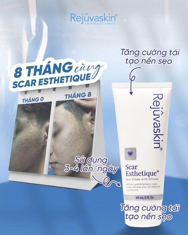 Da tuổi 25 hư tổn do mụn: skincare, ăn gì để tăng sinh collagen cho da mặt - Ảnh 8.