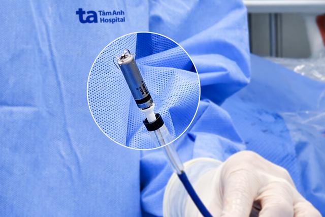Bệnh viện đầu tiên tại Việt Nam cấy máy tạo nhịp tim không dây thế hệ mới - Ảnh 5.